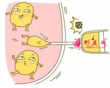 做腰腹部吸脂后影響懷孕嗎？
