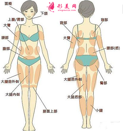 腰腹部吸脂要注意的護(hù)理事項(xiàng)