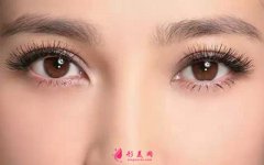 切開雙眼皮術(shù)后吃什么比較好？