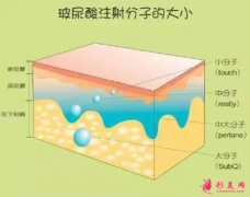 玻尿酸填充臉部效果保持多久？