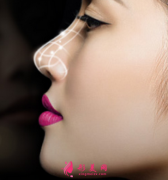 假體隆鼻效果好不好？