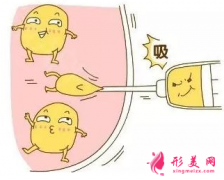 腹部吸脂術(shù)后要怎么護理？