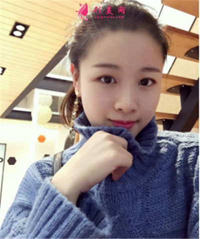 福州種植發(fā)際線術(shù)后恢復(fù)情況分享 術(shù)后 福州種植發(fā)際線術(shù)后恢復(fù)情況分享