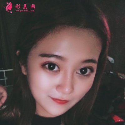 鄭州締萊美醫(yī)療美容醫(yī)院鼻部多項(xiàng)案例