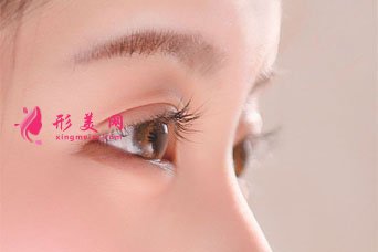 切開雙眼皮大約多少錢