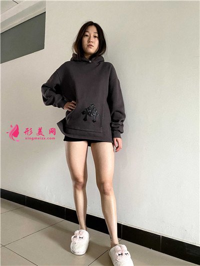 深圳水動(dòng)力吸脂瘦大腿術(shù)后恢復(fù)情況分享