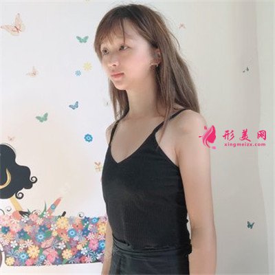 貴陽小姐姐假體隆胸術后恢復效果對比