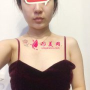 上海華美整形醫(yī)院做假體隆胸后走上性感路線