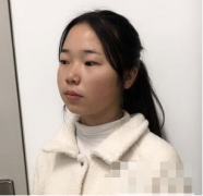 西安高一生醫(yī)療美容醫(yī)院價(jià)格表，附面部吸脂案例分享