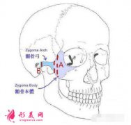 顴骨寬大：做一個(gè)顴弓內(nèi)推術(shù)治標(biāo)又治本！