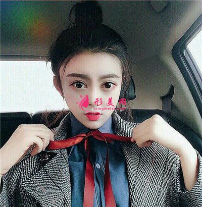 杭州全切雙眼皮術(shù)后恢復(fù)效果反饋