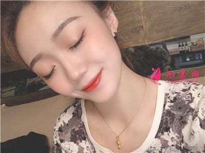 杭州小仙女的面部線雕術(shù)后效果分享 術(shù)后 杭州小仙女的面部線雕術(shù)后效果分享