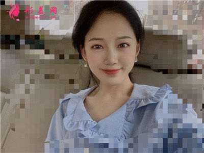 濟南鼻綜合術后恢復情況對比圖分享