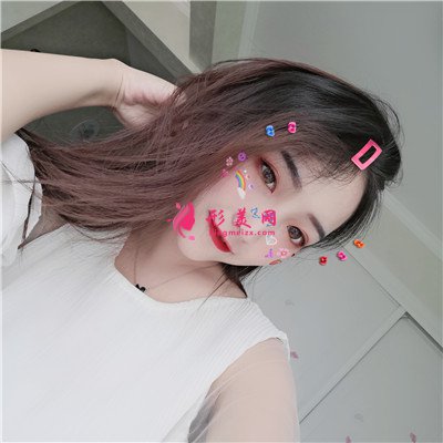 廈門全切雙眼皮術(shù)后案例效果分享