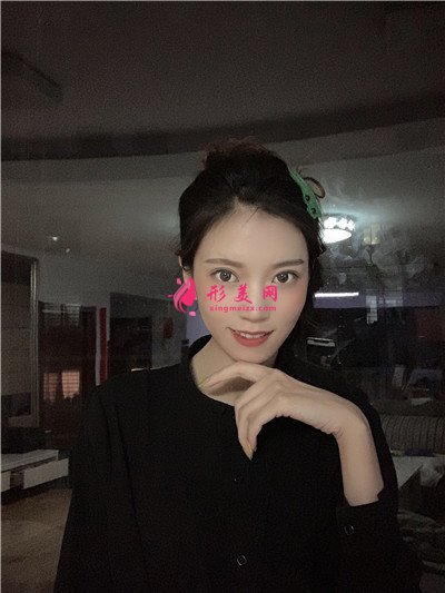 河南面部埋線提升術(shù)后效果分享