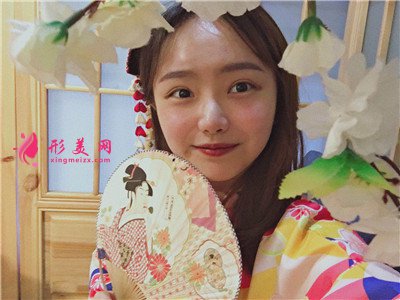 成都小姐姐種植發(fā)際線手術(shù)術(shù)后效果分享