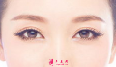 全切雙眼皮的費(fèi)用是多少？