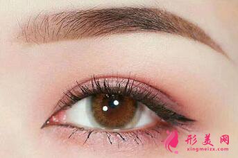 開眼角手術(shù)需要多長(zhǎng)時(shí)間