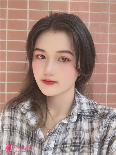 深圳全切雙眼皮術(shù)后恢復(fù)效果對比圖分享