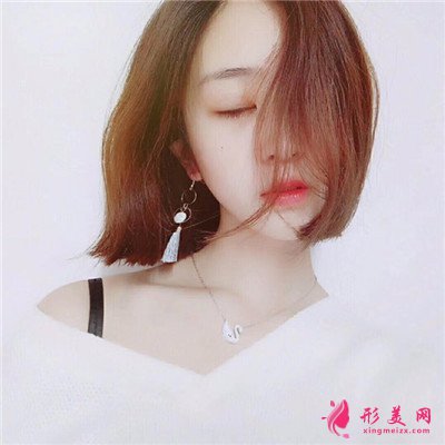 南昌切開雙眼皮術(shù)后恢復(fù)效果展示，小姐姐的模樣好標(biāo)致啊~