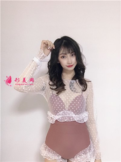 武漢全切雙眼皮術(shù)后恢復(fù)效果展示