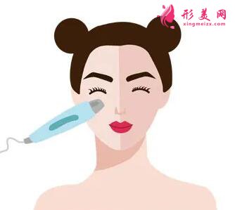 超光子嫩膚治療后多久看到效果