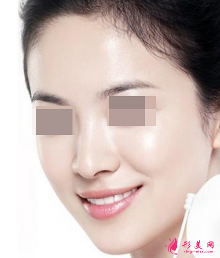 超光子嫩膚效果可以保持多久