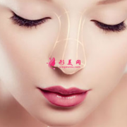 假體隆鼻費(fèi)用大概是多少?