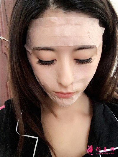 成都小仙女鼻綜合手術(shù)術(shù)后案例反饋