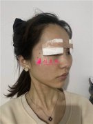 昆明市第一人民醫(yī)院星耀醫(yī)院眼部多項(xiàng)手術(shù)術(shù)后效果對比