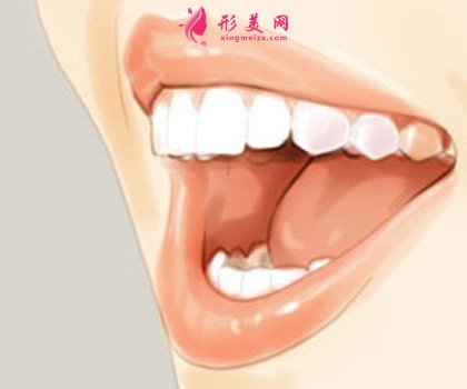牙齒隱形矯正過(guò)程痛嗎