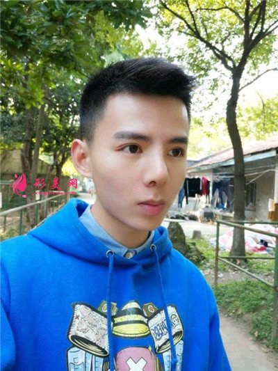 福州小哥哥鼻綜合術(shù)后恢復(fù)效果分享