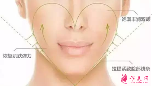 自體脂肪填充臉部會有硬塊嗎