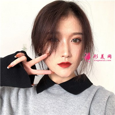 武漢小仙女全切雙眼皮術(shù)后恢復(fù)情況反饋