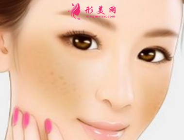 激光祛斑后有反黑癥狀正常嗎