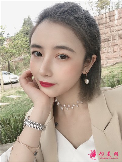 鄭州鼻綜合術(shù)后恢復(fù)效果對比圖反饋