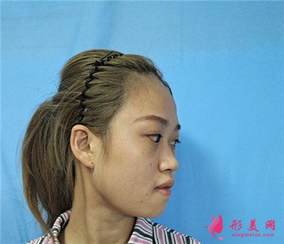 5647c76a141c-audio.jpg