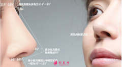 自體軟骨隆鼻的恢復(fù)期長(zhǎng)嗎？