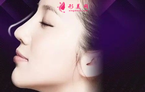 自體軟骨隆鼻手術(shù)后會(huì)變形嗎