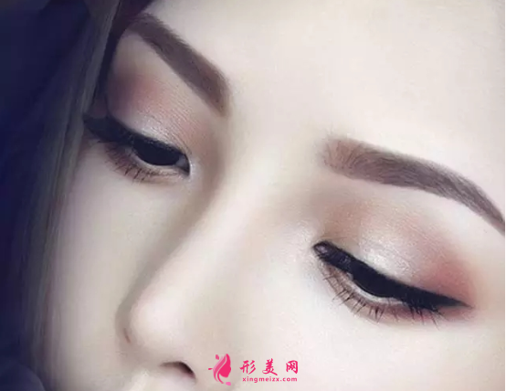 假體隆鼻術(shù)后會(huì)移動(dòng)嗎