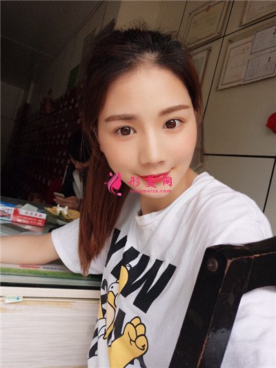 武漢自體脂肪面部填充術(shù)后效果反饋
