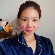 武漢藝星醫(yī)療美容醫(yī)院自體脂肪面部填充術后效果反饋