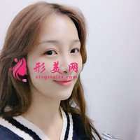 自體脂肪活細胞除皺真實體驗分享