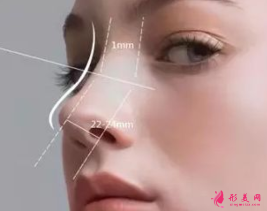 假體隆鼻恢復(fù)期要多久