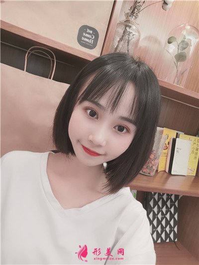 武漢小仙女眼部綜合術(shù)后恢復(fù)情況分享