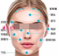 自體脂肪填充臉部多久恢復自然