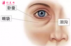 手術祛眼袋后可以化妝嗎？