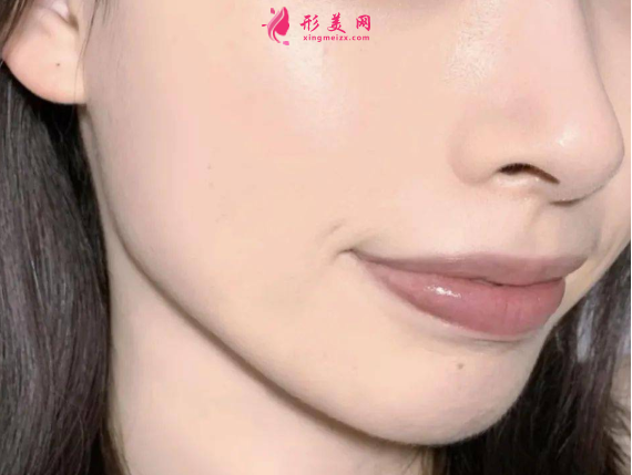 激光祛斑價(jià)格大概是多少