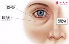 祛眼袋手術(shù)后可以喝酒嗎？