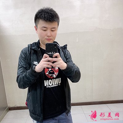 重慶毛發(fā)移植手術(shù)術(shù)后恢復(fù)情況分析